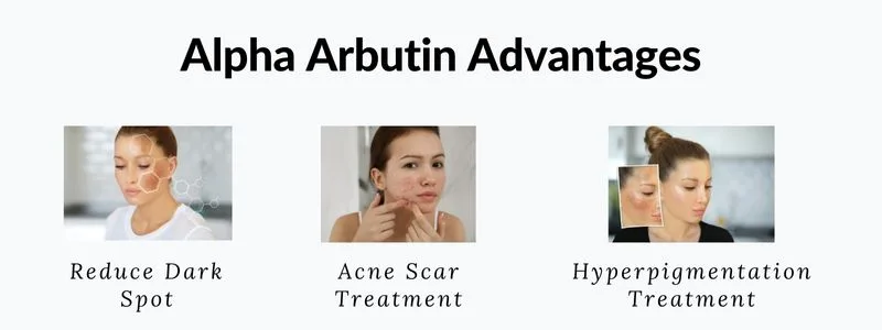 Alpha Arbutin: Its Uses, Skin Healing, And 3 Skin Benefits